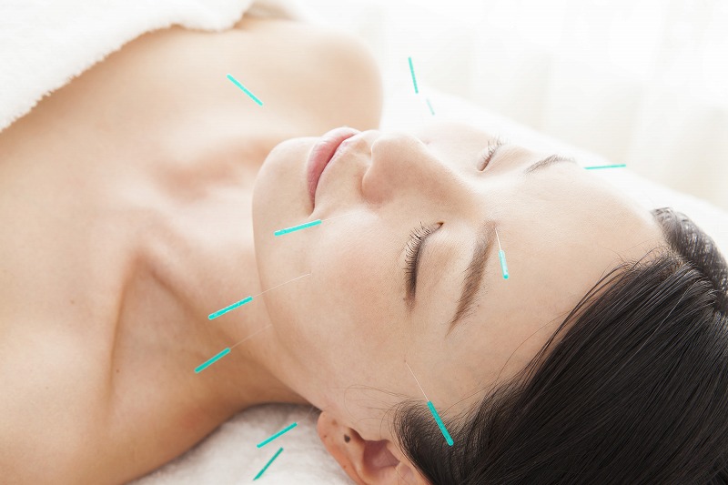 Facial acupuncture